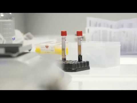 LE ANALISI DEI TAMPONI AL COTUGNO: CIRCA MILLE AL GIORNO, ECCO COME VENGONO EFFETTUATE (VIDEO CORRIERE DELLA SERA)