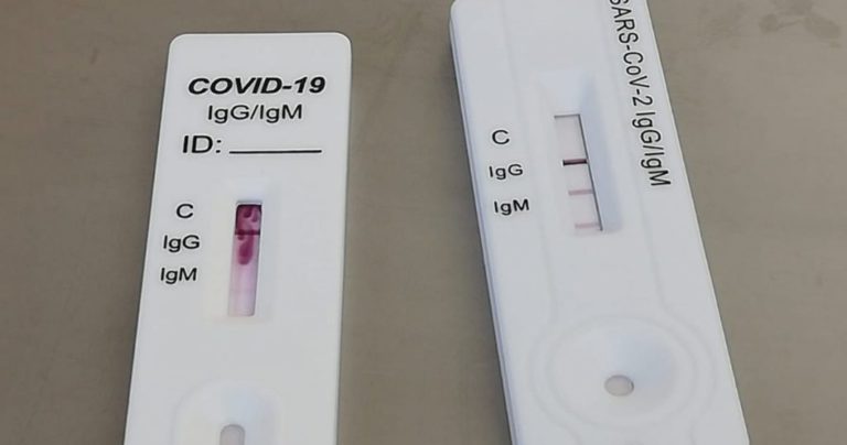 TEST RAPIDI BLOCCATI IN CINA, I COMUNI ISOLANI DEVONO ATTENDERE