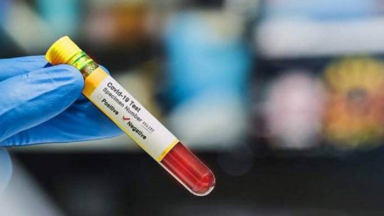 AD ISCHIA GUARITO DAL COVID 19 UN INTERO NUCLEO FAMILIARE! 41 IL TOTALE DEI GUARITI SULL’ISOLA