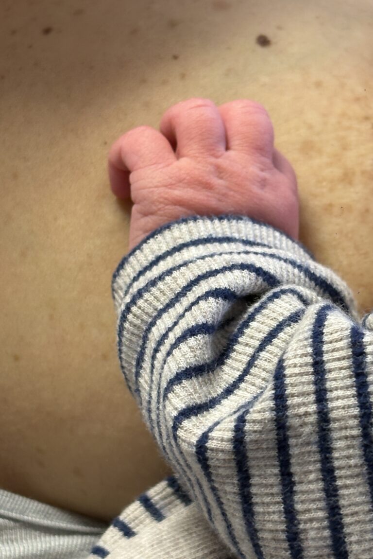 Ischia, fiocco azzurro al Rizzoli: il primo nato del 2026 e’ Jacopo Francesco che bussa in anticipo da Procida